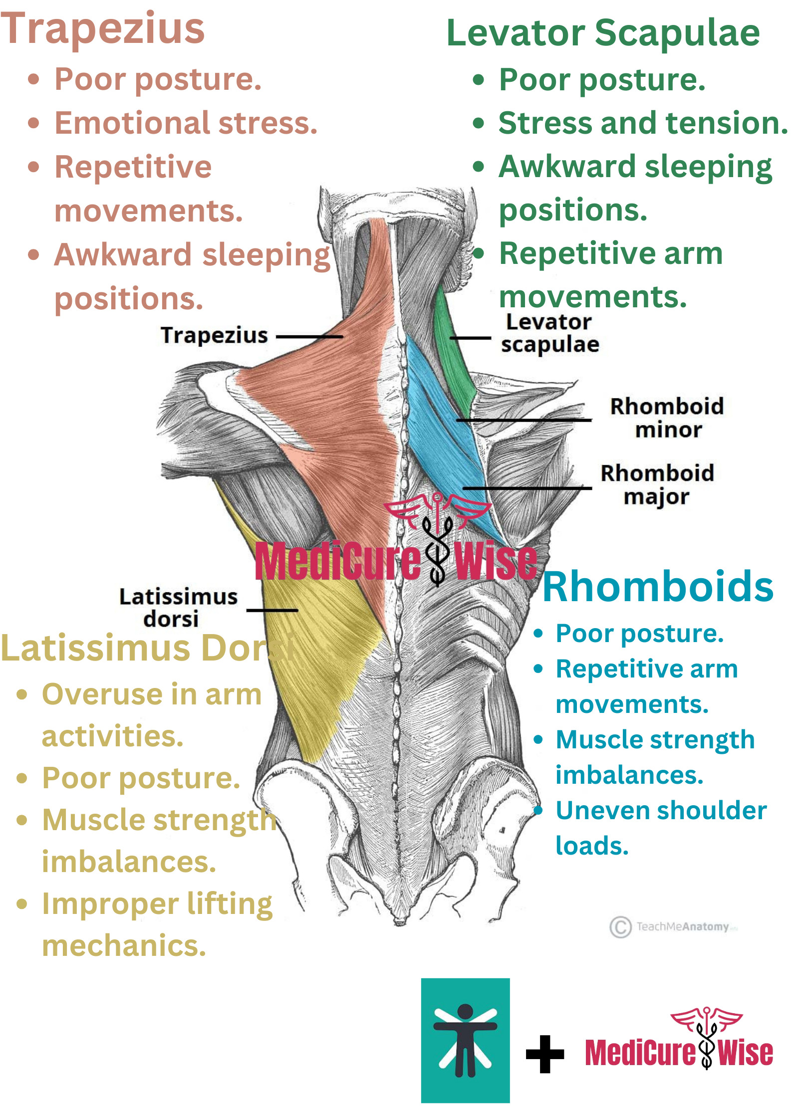 The Ultimate Back Pain Location Chart MediCure Wise the-ultimate-back-pain-location-chart-medicure-wise